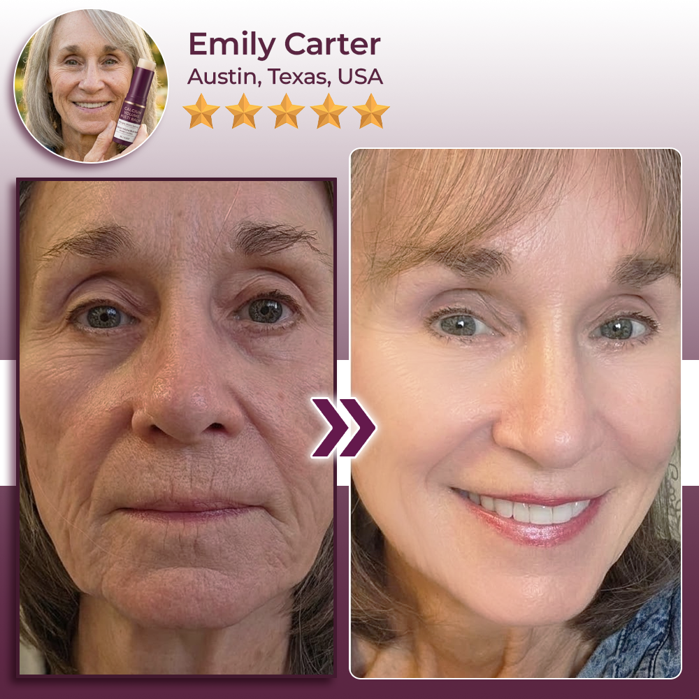 SEAGRIL® Calcium Volume Botox Balm (KRHU)