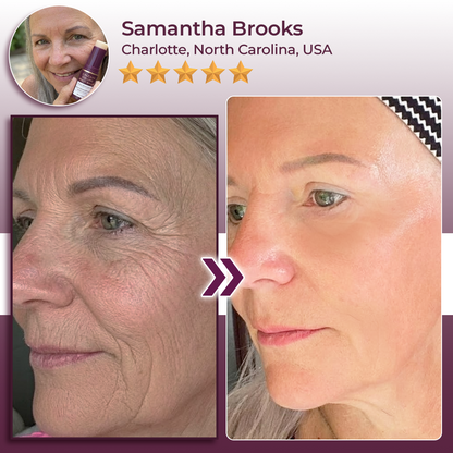 SEAGRIL® Calcium Volume Botox Balm (KRHU)
