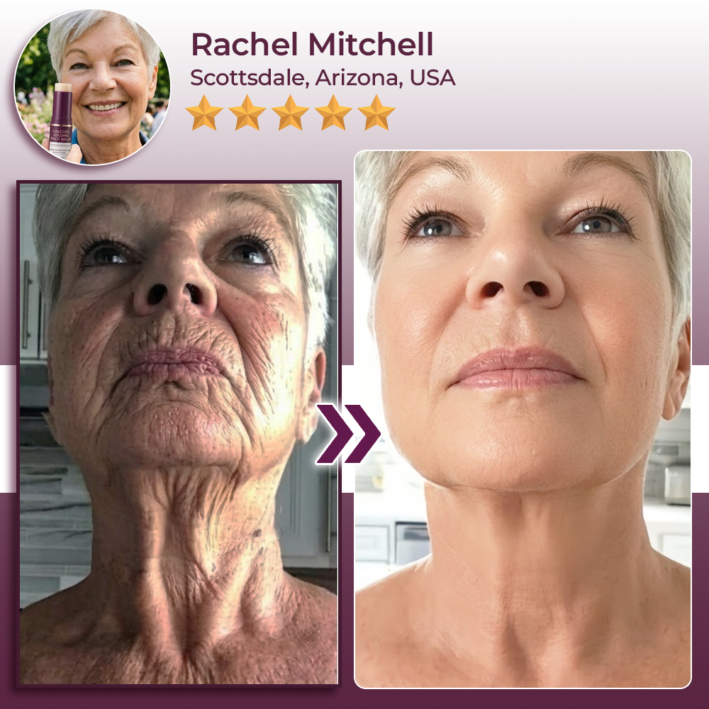 SEAGRIL® Calcium Volume Botox Balm (KRHU)