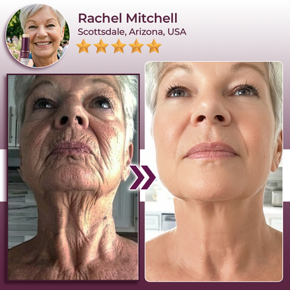 SEAGRIL® Calcium Volume Botox Balm (KRHU)