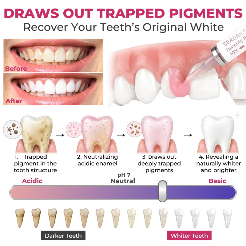 DenPerm Cavity-Repair Natural Enamel Filling Gel